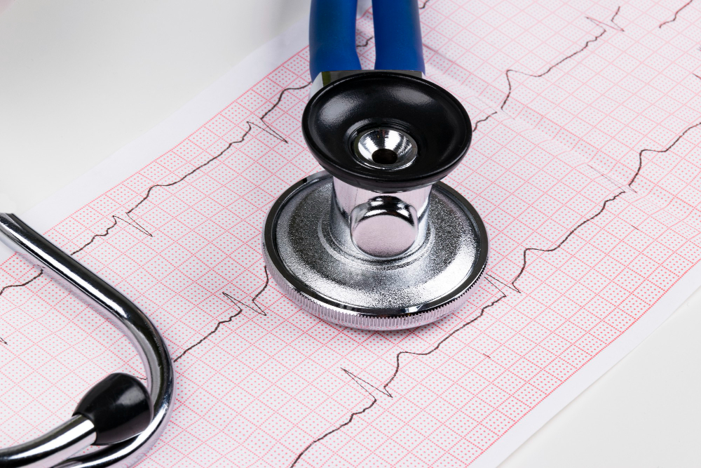 Hapvida integra sistemas e disponibiliza laudos de eletrocardiograma em até 15 minutos