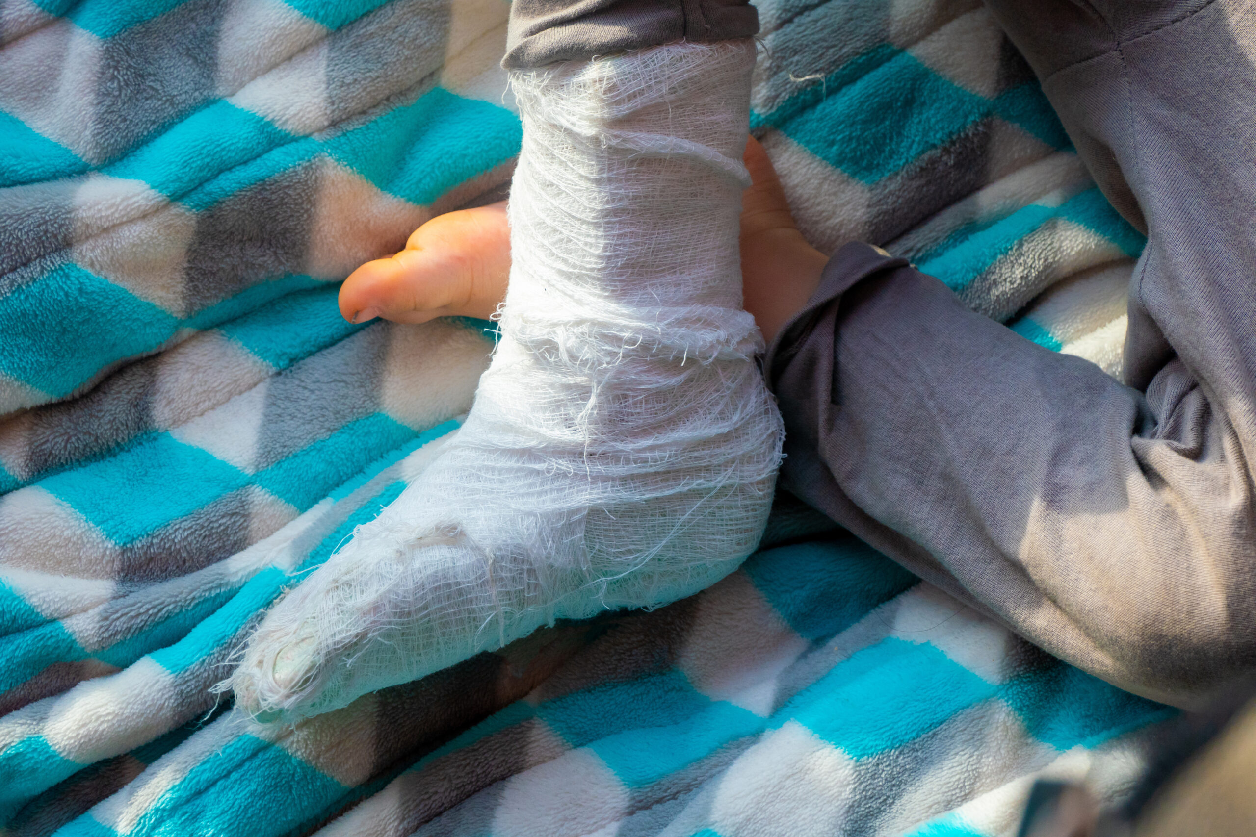 Dia das Crianças: Cuidado redobrado com os pequenos para evitar quedas e lesões graves