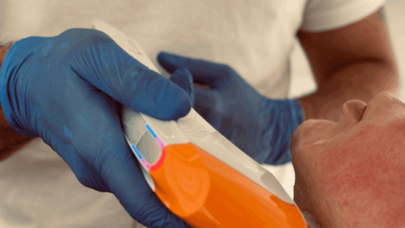 Tratamentos estéticos não invasivos crescem entre mulheres a partir dos 40 anos